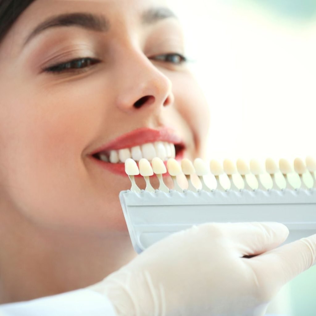 Teeth Whitening QL Dental